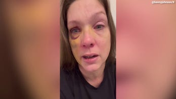 Cincinnati beating victim speaks out