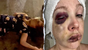 Cincinnati beatdown victim reveals 'very bad brain trauma' in first remarks since viral assault